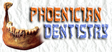 Phoenician Dentistry: Phoenician Dental Art